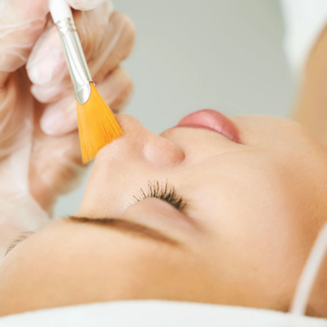 Chemical peel training course - SkinTech Aesthetics Training Academy